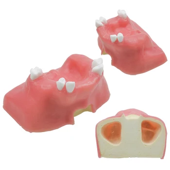Implant dentar Modelul de Predare Sinusului Maxilar cu Dinții Model pentru Dentist Student care Studiază Materiale Dentare